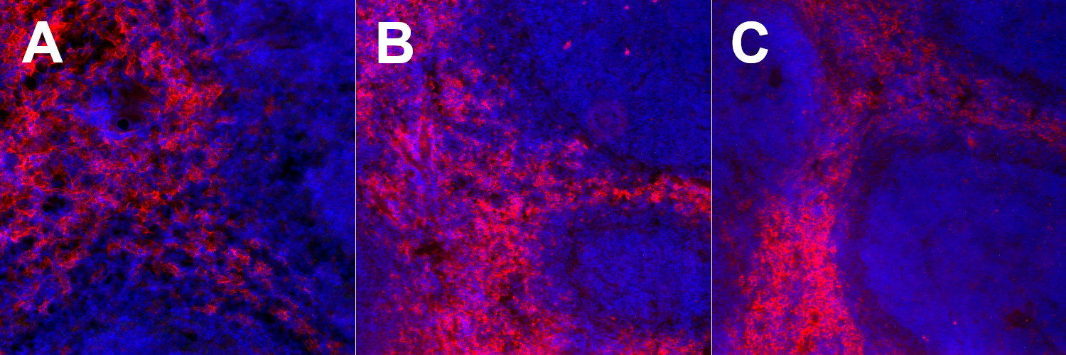 Using F4/80 as a marker for macrophage subsets in multiplex